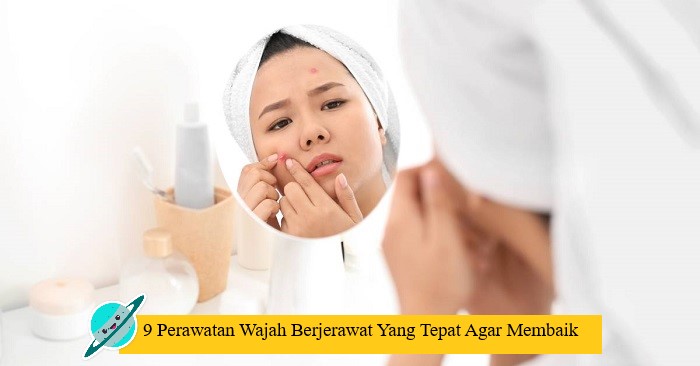 9 Perawatan Wajah Berjerawat Yang Tepat Agar Membaik